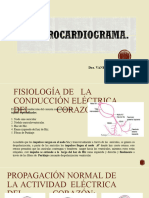 Electrocardiogram A