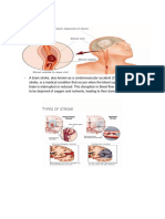 Pathophysiology