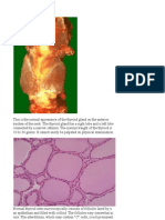 ENDOCRINE PATHOLOGY Webpath