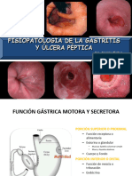 Gastritis y Úlcera Péptica