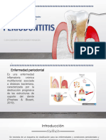 Enfermedad Periodontal