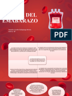 Infografia de Anemia