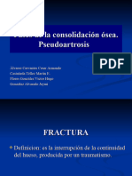 Fases de La Consolidación Ósea. Pseudoartrosis