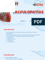 Valvulopatías 