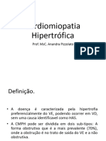 Aula 17 Miocardiopatia Hipertrófica Template Ipemed