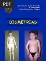 35 - Dismetria de Extremidades Inferiores