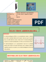 EKG