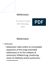 Atelectasis