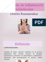 Artritis Reumatoide.