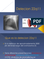 Delecion 22q11