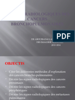 ASPECTS RADIOLOGIQUES DES CANCERS BRONCHOPULMONAIRES (Enregistrement Automatique)