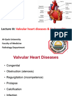 Lecture III Valvular Heart Diseases and Endocarditis