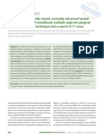 The Combined Laterally Closed, Coronally Advanced Tunnel For The Treatment of Mandibular Multiple Adjacent Gingival Recessions