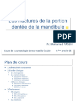 Les Fractures de La Portion Dentée de La Mandibule