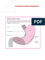 Gastric Cancer Nursing Care Plan & Management