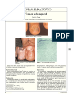 CASOS PARA EL DIAGNÓSTICO Tumor Subungueal Patricia Chang