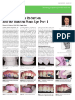 Controlling Tooth Reduction 