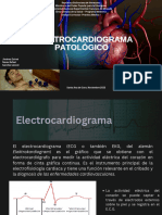 Pm. Ecg Patológico