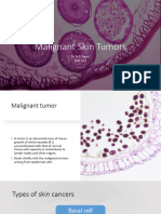 Malignant Skin Tumors BNS 313 - 2023