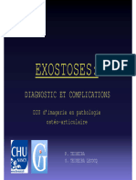 Exostoses. 2