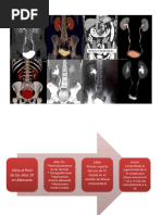 Patologías en Urograma Excretor