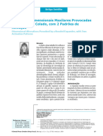 2001 - Alterações Dimensionais Maxilares Provocadas Por Expansor Colado, Com 2 Padrões de Ativação