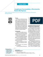 2001 - Dentes Com Rizogênese Incompleta e Movimento Ortodôntico Bases Biológicas