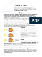 Trabalho de Fisíca (Defeitos Da Visão) 2p