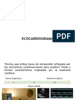 ECOCARDIOGRAMA