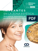 Implantes en La Zona Estetica - Todd R. Schoenbaum