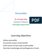 Pericarditis