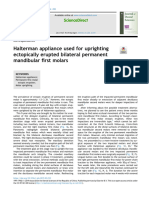 Halterman Appliance Used For Uprightingectopically Erupted Bilateral Permanentmandibular First Molars