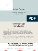 For Uterine Polyps. Racheal Rai