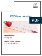 ECG Interpretation: Prepared by