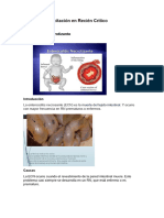 4 Enterocolitis Necrotizante