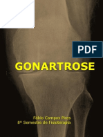 GONARTROSE