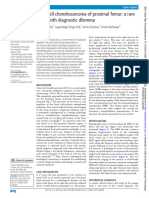 Clear Cell Chondrosarcoma of Proximal Femur: A Rare Entity With Diagnostic Dilemma