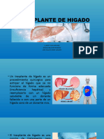 Transplante de Higado