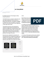 Brain Tumor MRI Detection Using Matlab