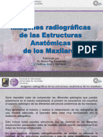 Zonas Radiograficas Superiores