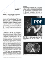 Surgical Management of Carolis Disease I