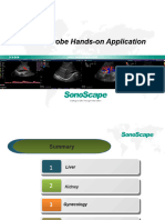 Convex Probe Hands-On Application