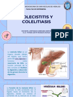 Colelitiasis y Colecistitis