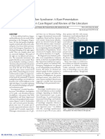 Muthu Et Al 2015 Image Diagnosis Weber Syndrome A Rare Presentation of Acute Leukemia A Case Report and Review of The