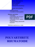 1 - Polyarthrite Rhumatoide