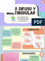 Bocio Difuso y Multinodular