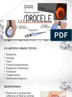 Hydrocele