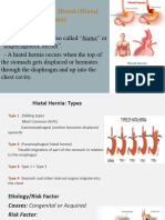 Diaphragmatic Hernia (Hiatal Hernia) FINAL