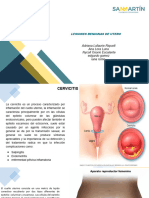 Lesiones Benignas de Utero