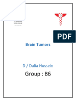 Brain Tumors - Docx 3333